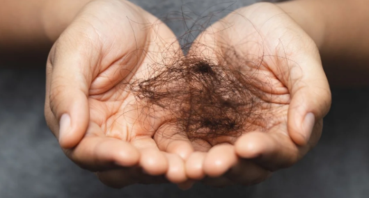 Embrace Natural Solutions for Healthy Hair: Combating Hair Loss without Harsh Chemicals